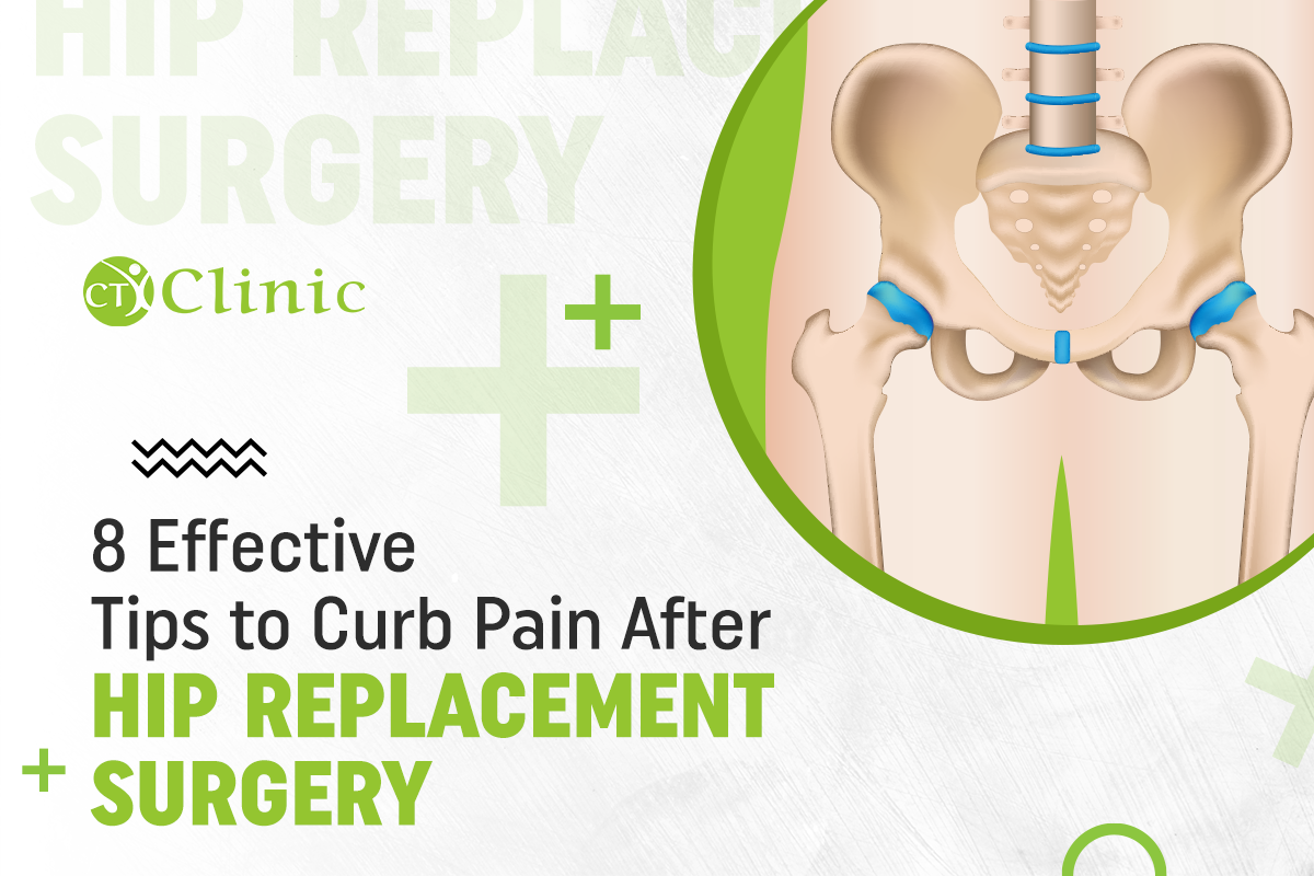 8 Effective Tips to Curb Pain After Hip Replacement Surgery